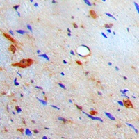 S100-A10 Rabbit Polyclonal Antibody