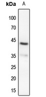 MKK4 (Phospho-S80) Rabbit Polyclonal Antibody