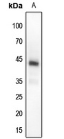 MKK4 (Phospho-T261) Rabbit Polyclonal Antibody