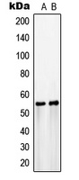 GLUT3 Rabbit Polyclonal Antibody
