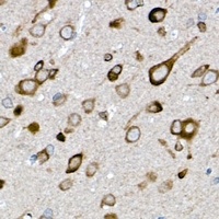 GLUT3 Rabbit Polyclonal Antibody