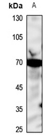 Acid Sphingomyelinase Rabbit Polyclonal Antibody