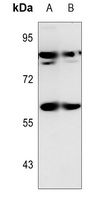 SNX1 Rabbit Polyclonal Antibody