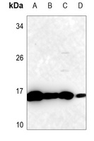 SOD1 Rabbit Polyclonal Antibody