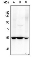 SOX9 (Phospho-S181) Rabbit Polyclonal Antibody