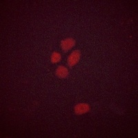 SOX9 (Phospho-S181) Rabbit Polyclonal Antibody