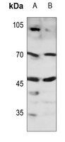 SOX11 Rabbit Polyclonal Antibody