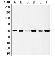 c-SRC (Phospho-S75) Rabbit Polyclonal Antibody