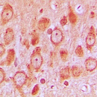 c-SRC (Phospho-S75) Rabbit Polyclonal Antibody