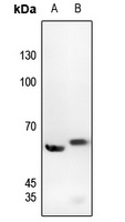 c-SRC (Phospho-Y529) Rabbit Polyclonal Antibody