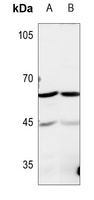 TROVE2 Rabbit Polyclonal Antibody