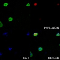 TROVE2 Rabbit Polyclonal Antibody