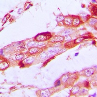 SSBP1 Rabbit Polyclonal Antibody