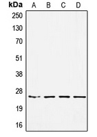 SSX-pan Rabbit Polyclonal Antibody
