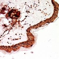 SSX-pan Rabbit Polyclonal Antibody