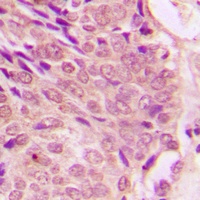 STAT1 (Phospho-S727) Antibody