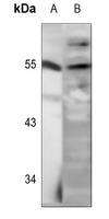 LKB1 (Phospho-S428) Rabbit Polyclonal Antibody