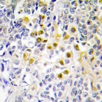 LKB1 (Phospho-S428) Rabbit Polyclonal Antibody