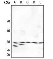 SURF1 Rabbit Polyclonal Antibody