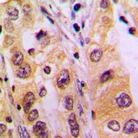 SURF1 Rabbit Polyclonal Antibody