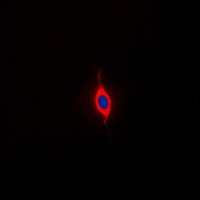 SURF1 Rabbit Polyclonal Antibody