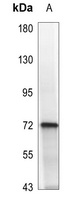 SYK (Phospho-Y323) Rabbit Polyclonal Antibody