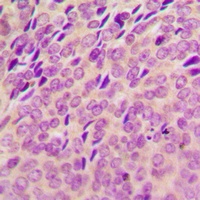 SYK (Phospho-Y348) Rabbit Polyclonal Antibody