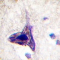 Synapsin 1 (Phospho-S62) Rabbit Polyclonal Antibody