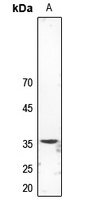 Synaptophysin Rabbit Polyclonal Antibody