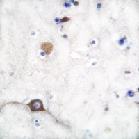 Synaptophysin Rabbit Polyclonal Antibody