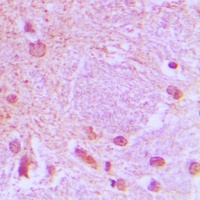 TCF3 Antibody