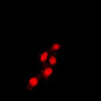 TEAD1 Rabbit Polyclonal Antibody
