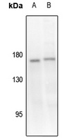 TIE2 (Phospho-Y1108) Antibody