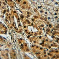 TIE2 (Phospho-Y1108) Antibody