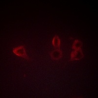 TIE2 (Phospho-Y1108) Antibody