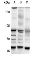 AP2 alpha/beta Rabbit Polyclonal Antibody