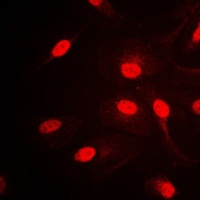 AP2 alpha/beta Rabbit Polyclonal Antibody