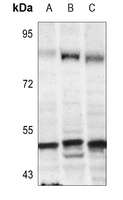 TFDP1 Rabbit Polyclonal Antibody