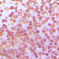 TFDP1 Rabbit Polyclonal Antibody
