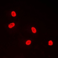 TFDP1 Rabbit Polyclonal Antibody