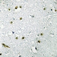 TFE3 Rabbit Polyclonal Antibody
