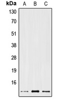PS2 Rabbit Polyclonal Antibody