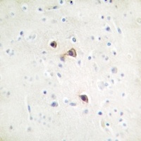 CD71 Rabbit Polyclonal Antibody