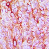 TGF alpha Rabbit Polyclonal Antibody