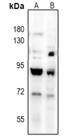 TGFBR2 Antibody