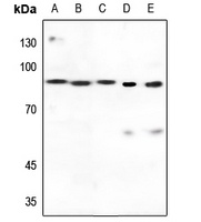 Transglutaminase 2 Rabbit Polyclonal Antibody