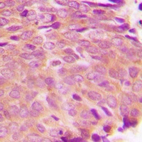 Transglutaminase 2 Rabbit Polyclonal Antibody
