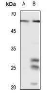 CD141 Rabbit Polyclonal Antibody