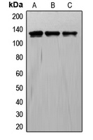 TIE1 Rabbit Polyclonal Antibody