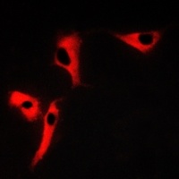 Tetraspanin 8 Rabbit Polyclonal Antibody